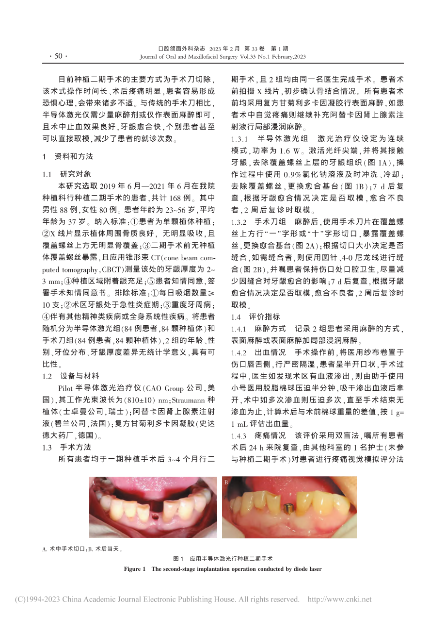 半导体激光在种植二期手术中的临床应用_附168例分析_李海鹏.pdf_第2页