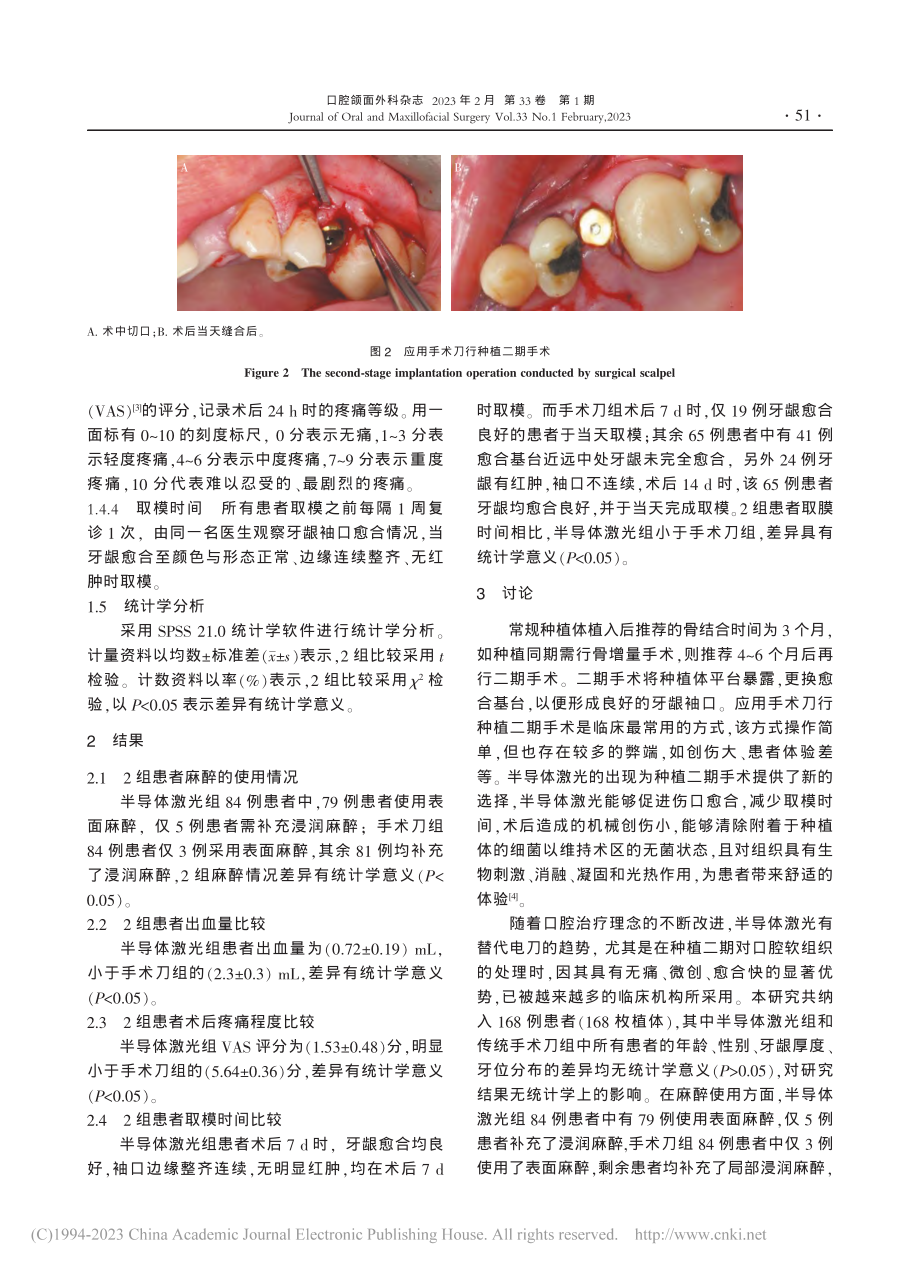 半导体激光在种植二期手术中的临床应用_附168例分析_李海鹏.pdf_第3页