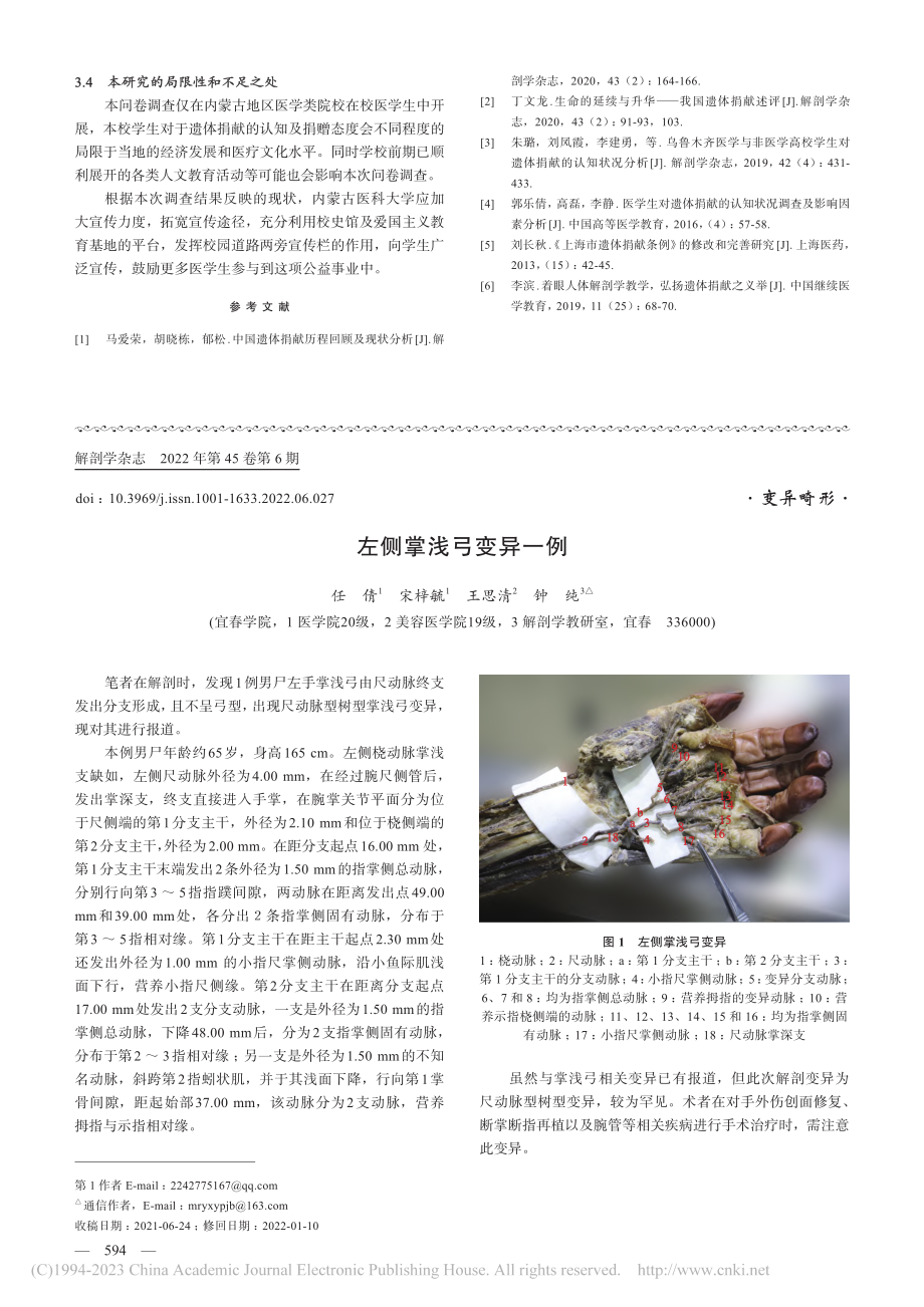 左侧掌浅弓变异一例_任倩.pdf_第1页