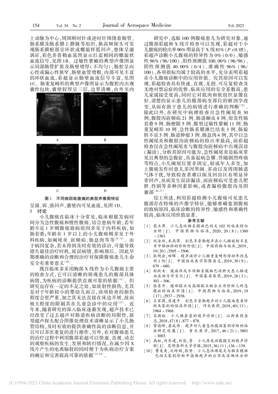 彩色多普勒超声对小儿腹痛的诊断及鉴别诊断价值研究_袁中明.pdf_第3页