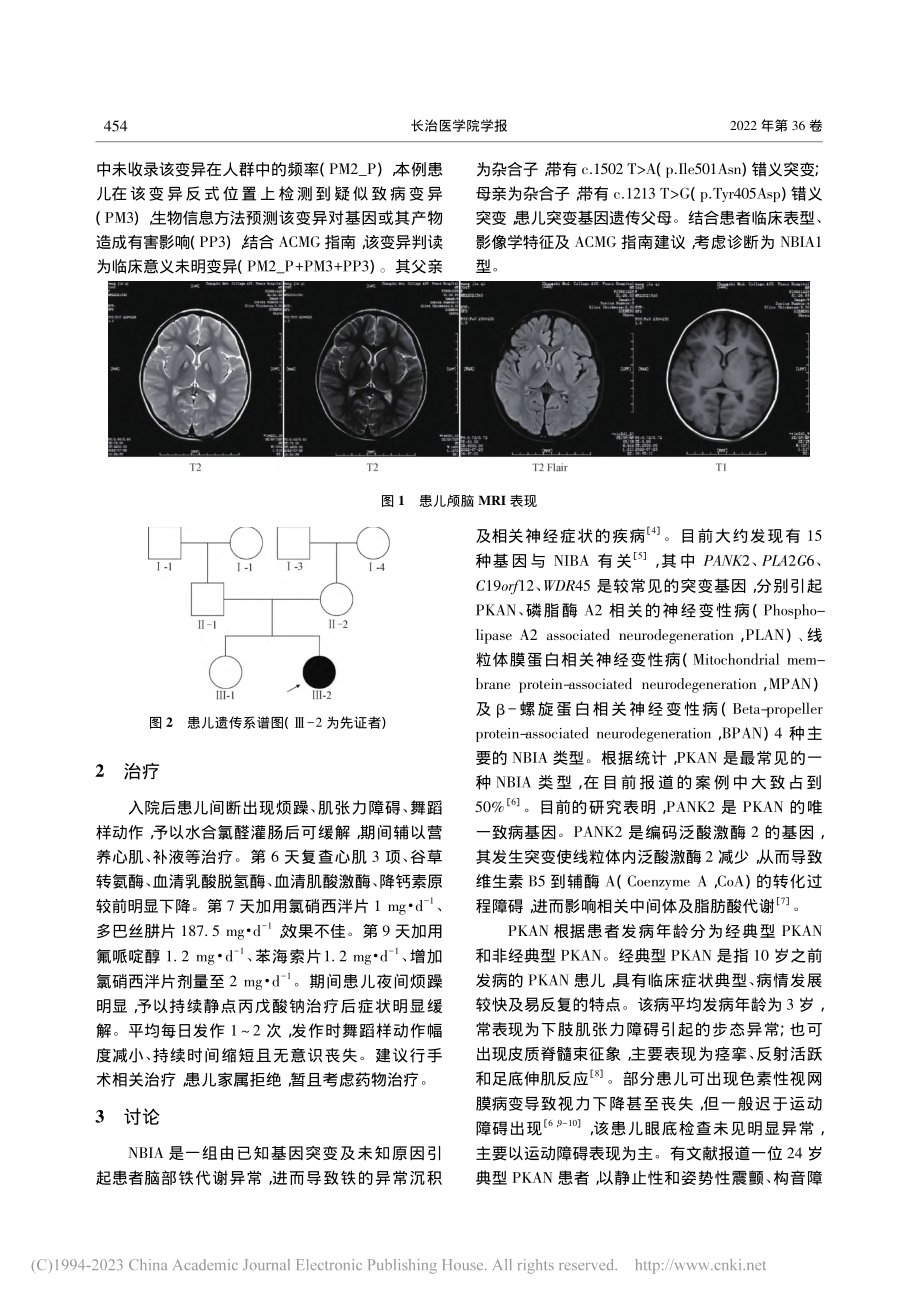 大脑铁沉积型神经退行性病变1型1例及文献回顾_林志宏.pdf_第2页