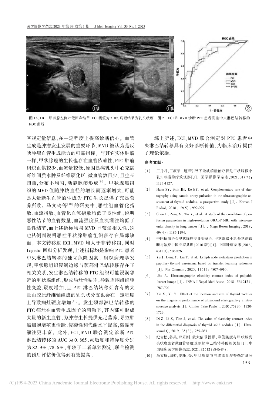 超声弹性对比指数联合微血管...腺乳头状癌淋巴结转移的分析_杨晓宇.pdf_第3页