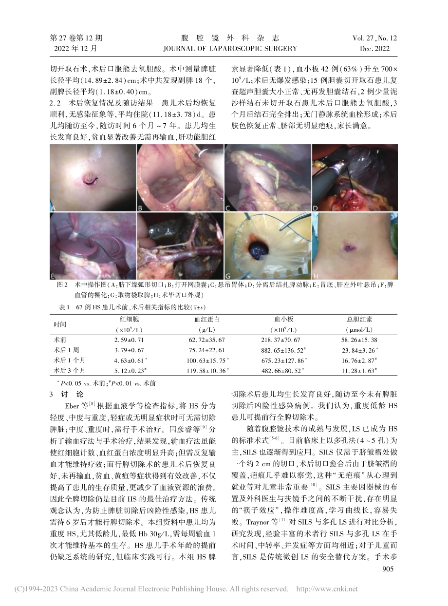 程序化单孔腹腔镜脾脏切除术...儿童遗传性球形红细胞增多症_李中策.pdf_第3页