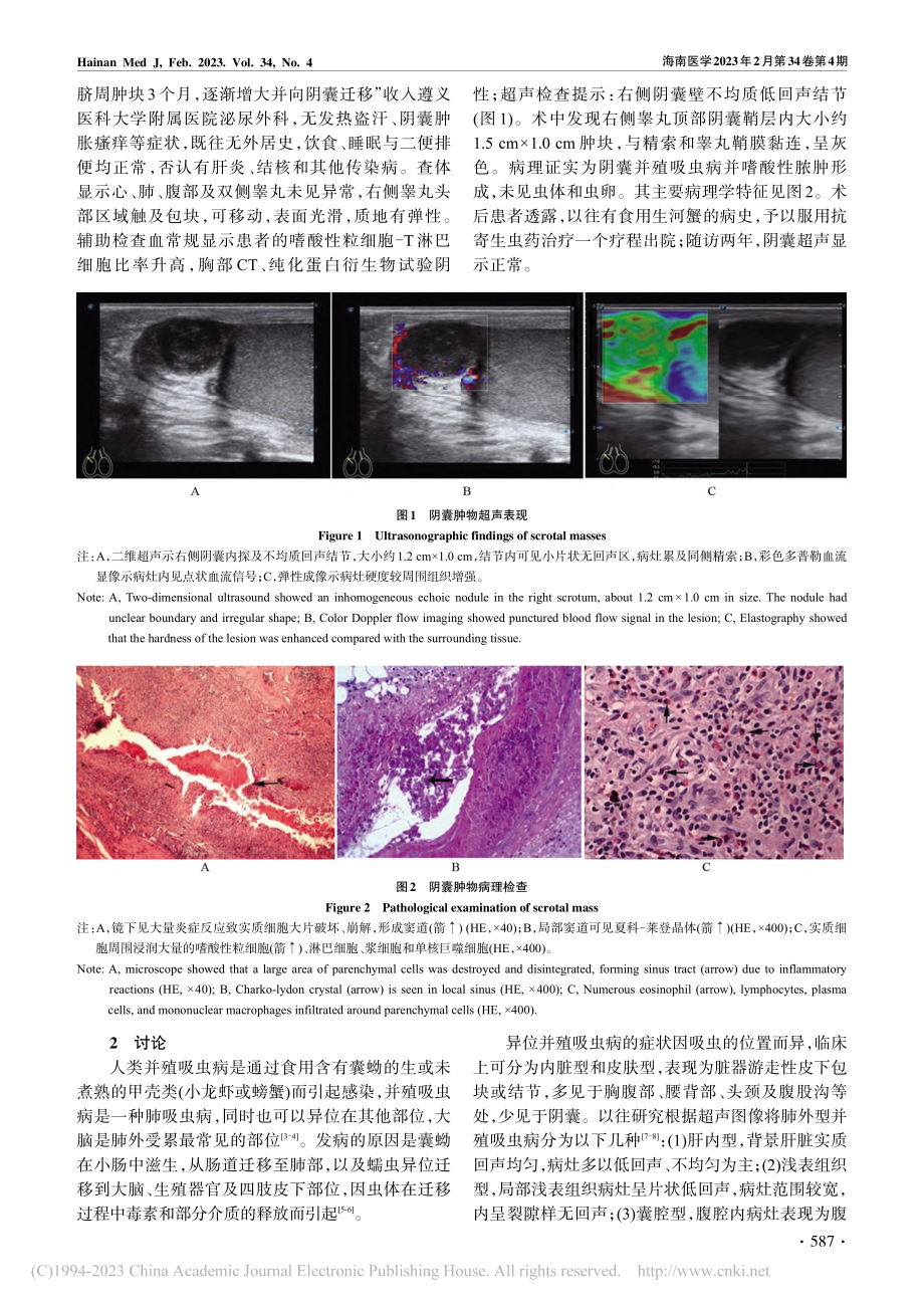 成人阴囊并殖吸虫病一例_杨光旭.pdf_第2页