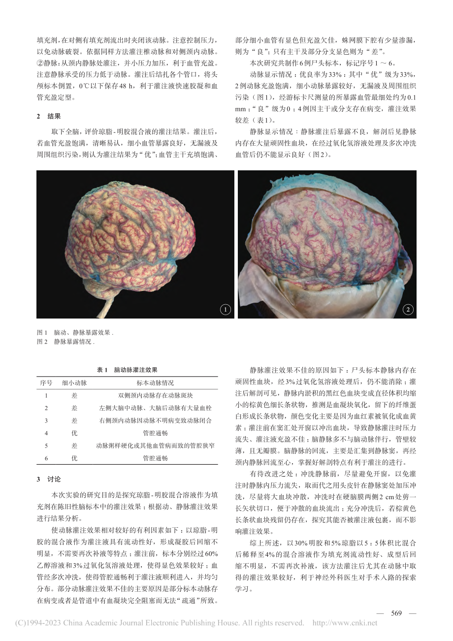 陈旧性脑血管标本的琼脂-明胶混合液灌注_张雪.pdf_第2页