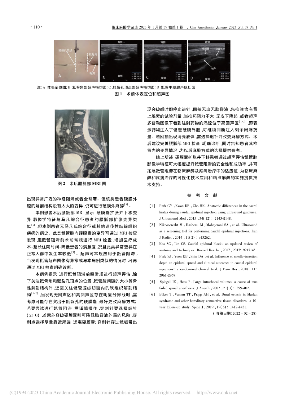 骶管腔内硬膜囊扩张并下移一例_张佩.pdf_第2页