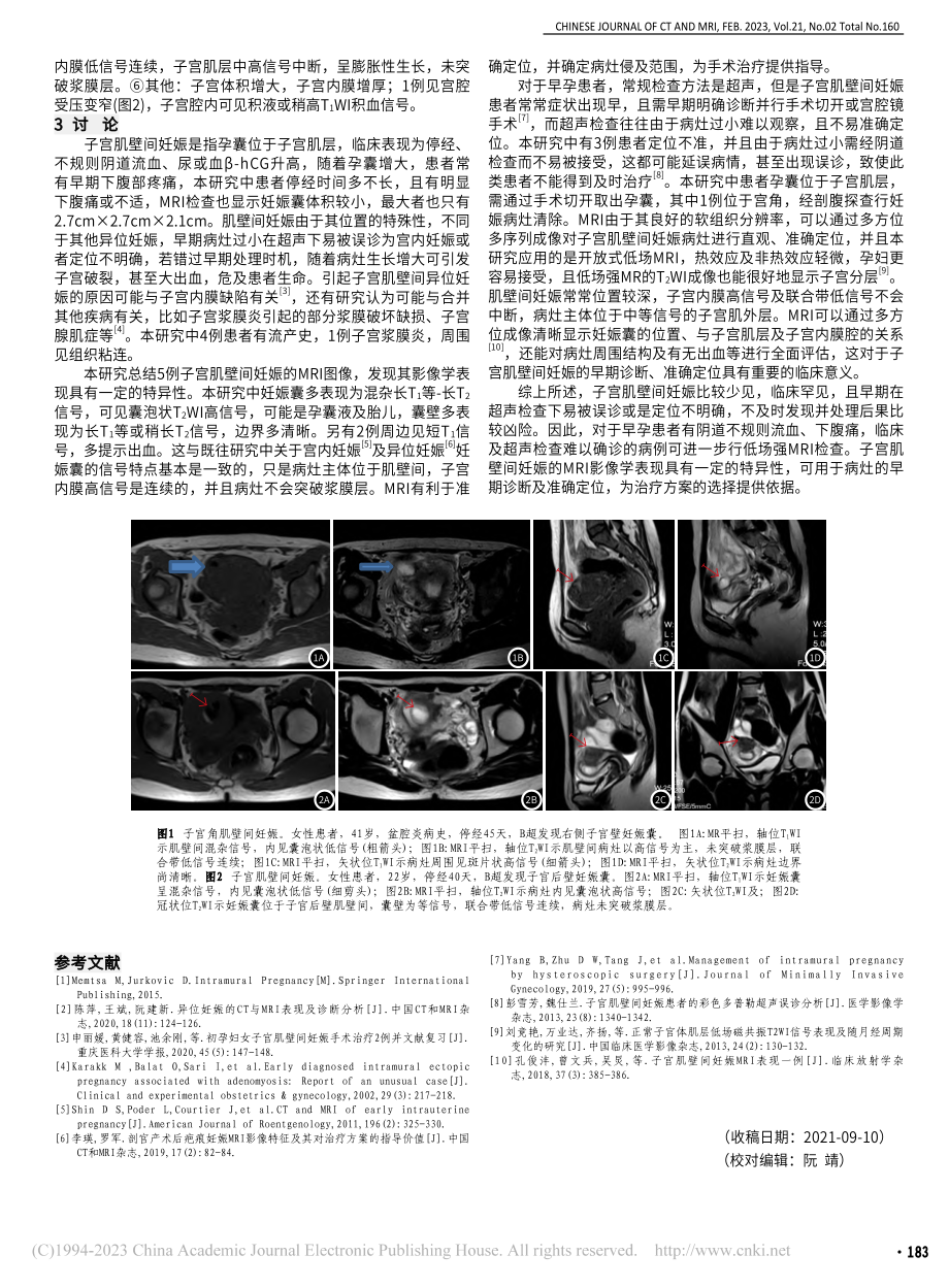 低场MRI对子宫肌壁间妊娠的诊断应用(附5例报道)_文小检.pdf_第2页