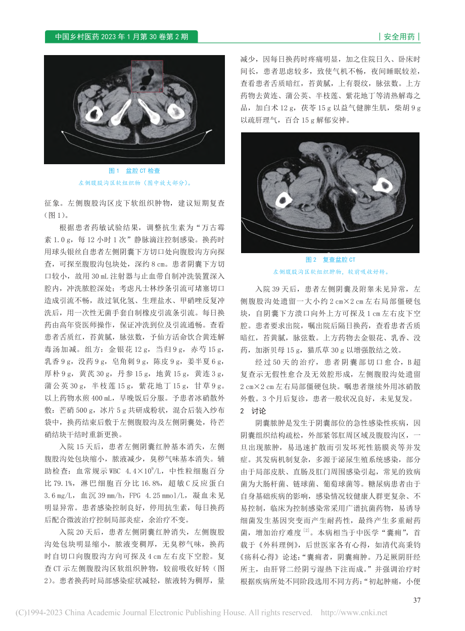 多重耐药菌致阴囊脓肿1例诊治分析_崔慧敏.pdf_第2页