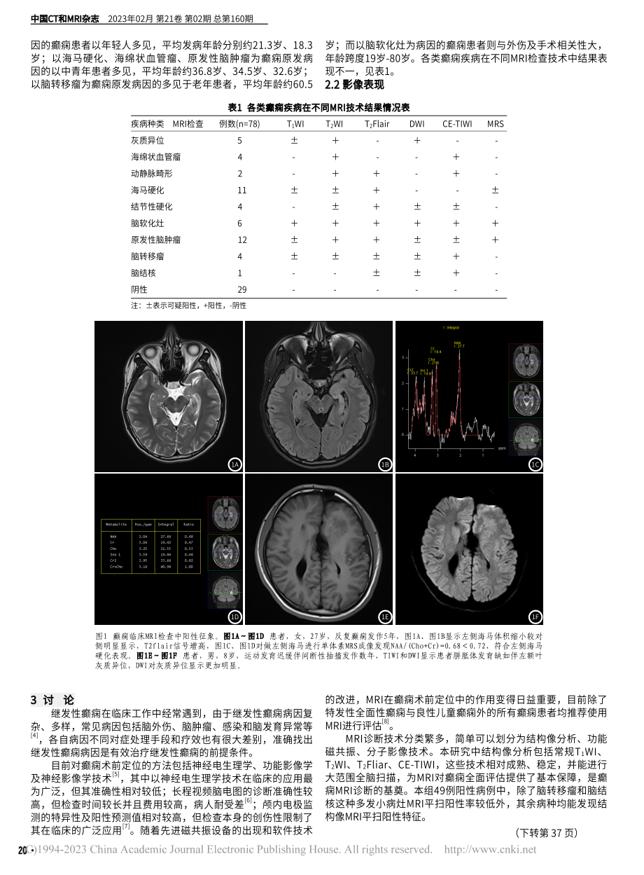 多模态MRI在癫痫患者临床评估中的价值研究_李胜开.pdf_第2页