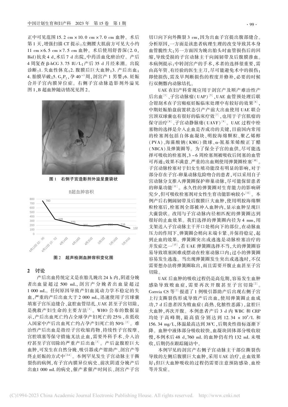 子宫动脉栓塞成功用于产时子...膜后巨大血肿1例并文献复习_吴诗瑶.pdf_第2页