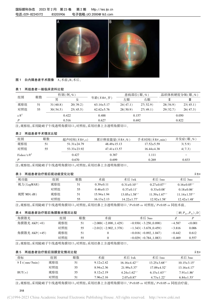 陡峭子午线透明角膜切口白内...和角膜散光及泪膜变化的影响_谢川.pdf_第3页