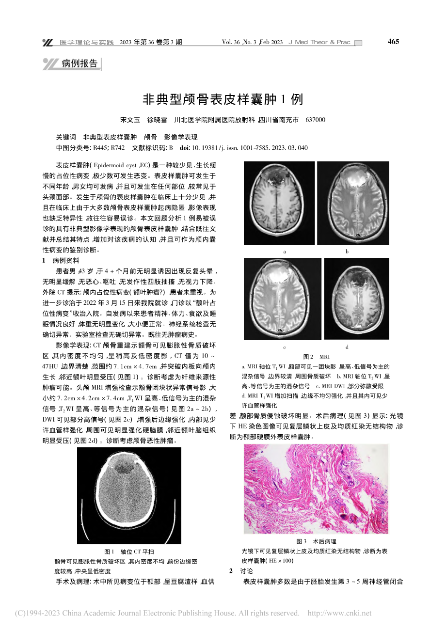 非典型颅骨表皮样囊肿1例_宋文玉.pdf_第1页