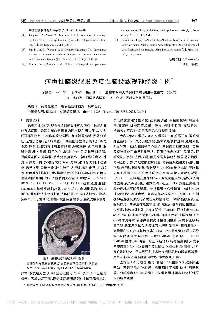 非典型颅骨表皮样囊肿1例_宋文玉.pdf_第3页