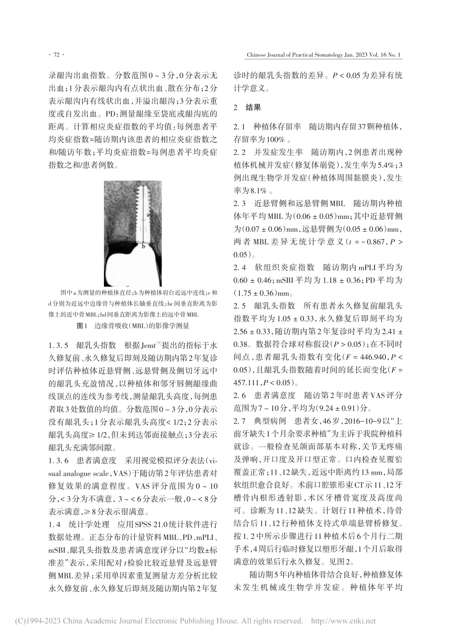 种植体支持式单端悬臂桥的中短期临床评价_张先玉.pdf_第3页