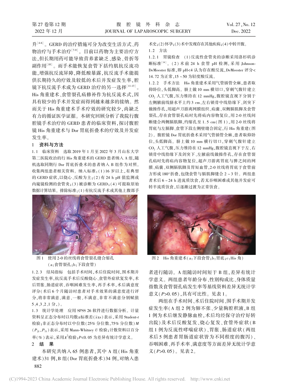 腹腔镜His角重建术与Do...胃食管反流病的疗效对比分析_李根.pdf_第2页