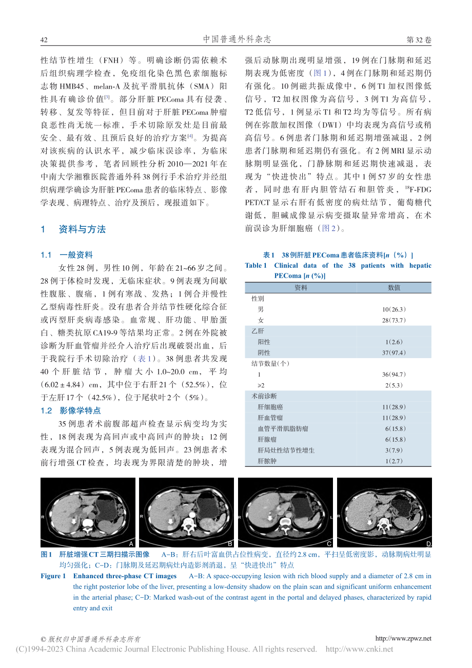 肝脏血管周上皮样细胞瘤38例临床诊治分析_苏文欣.pdf_第3页