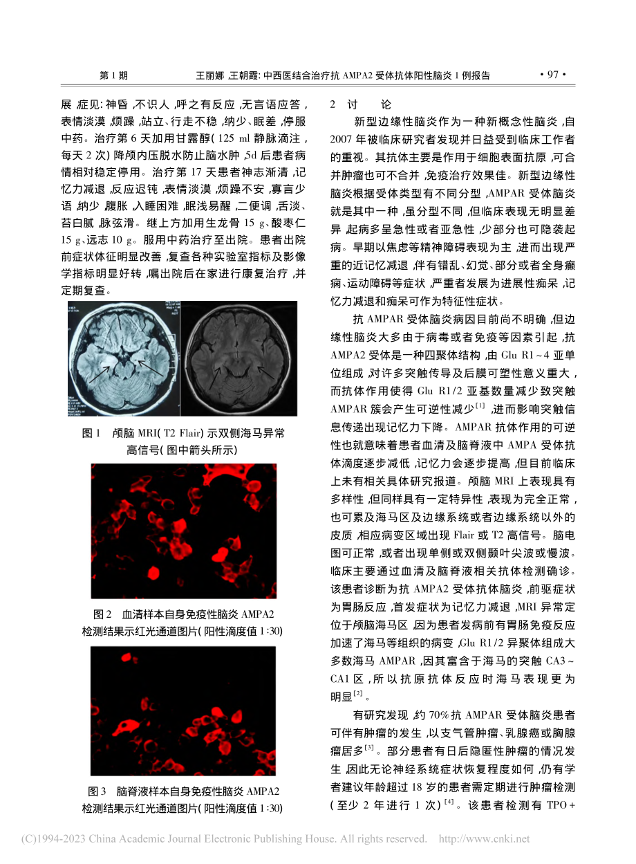 中西医结合治疗抗AMPA2受体抗体阳性脑炎1例报告_王丽娜.pdf_第2页