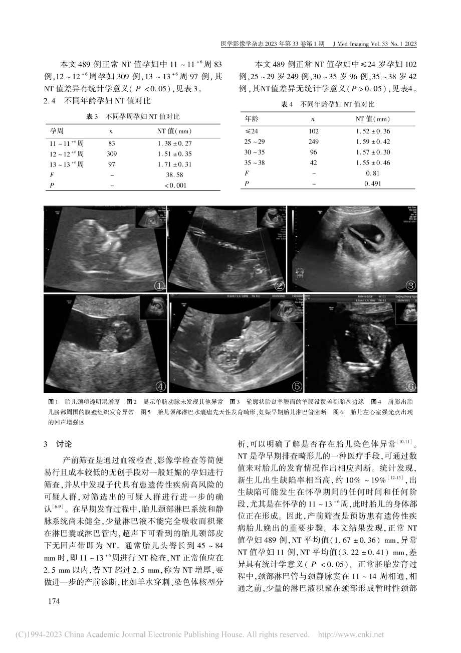 NT超声早孕期筛查对胎儿结构异常的诊断价值_陈云.pdf_第3页