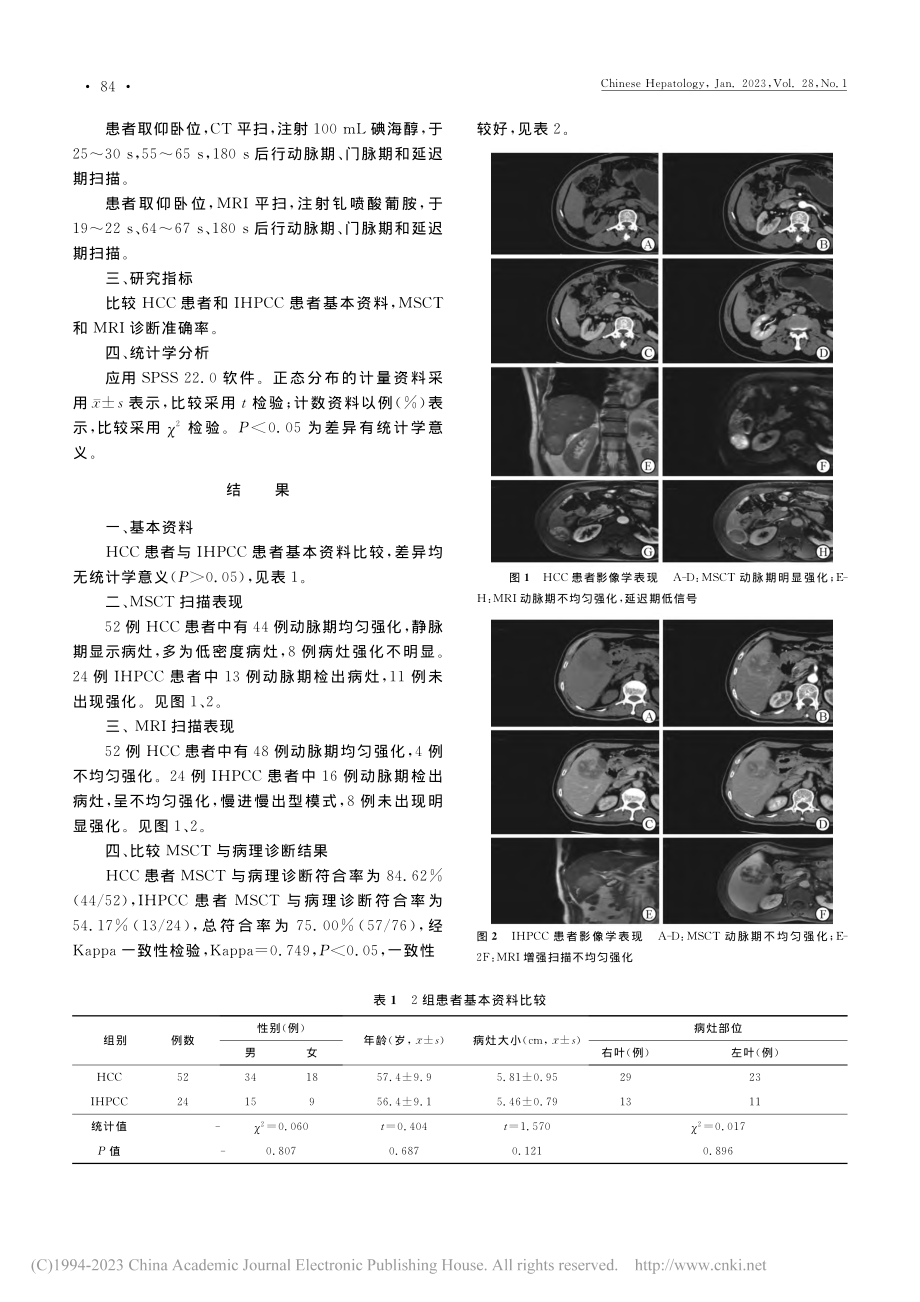 MSCT与MRI动态增强扫...CC与IHPCC的鉴别价值_殷锐.pdf_第2页