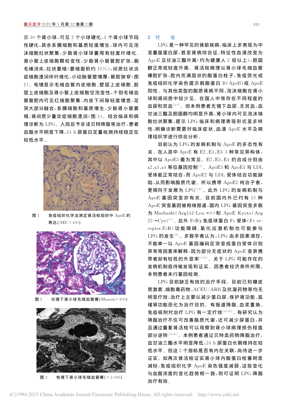 表现为少量蛋白尿脂蛋白肾病1例并文献复习_唐君平.pdf_第2页