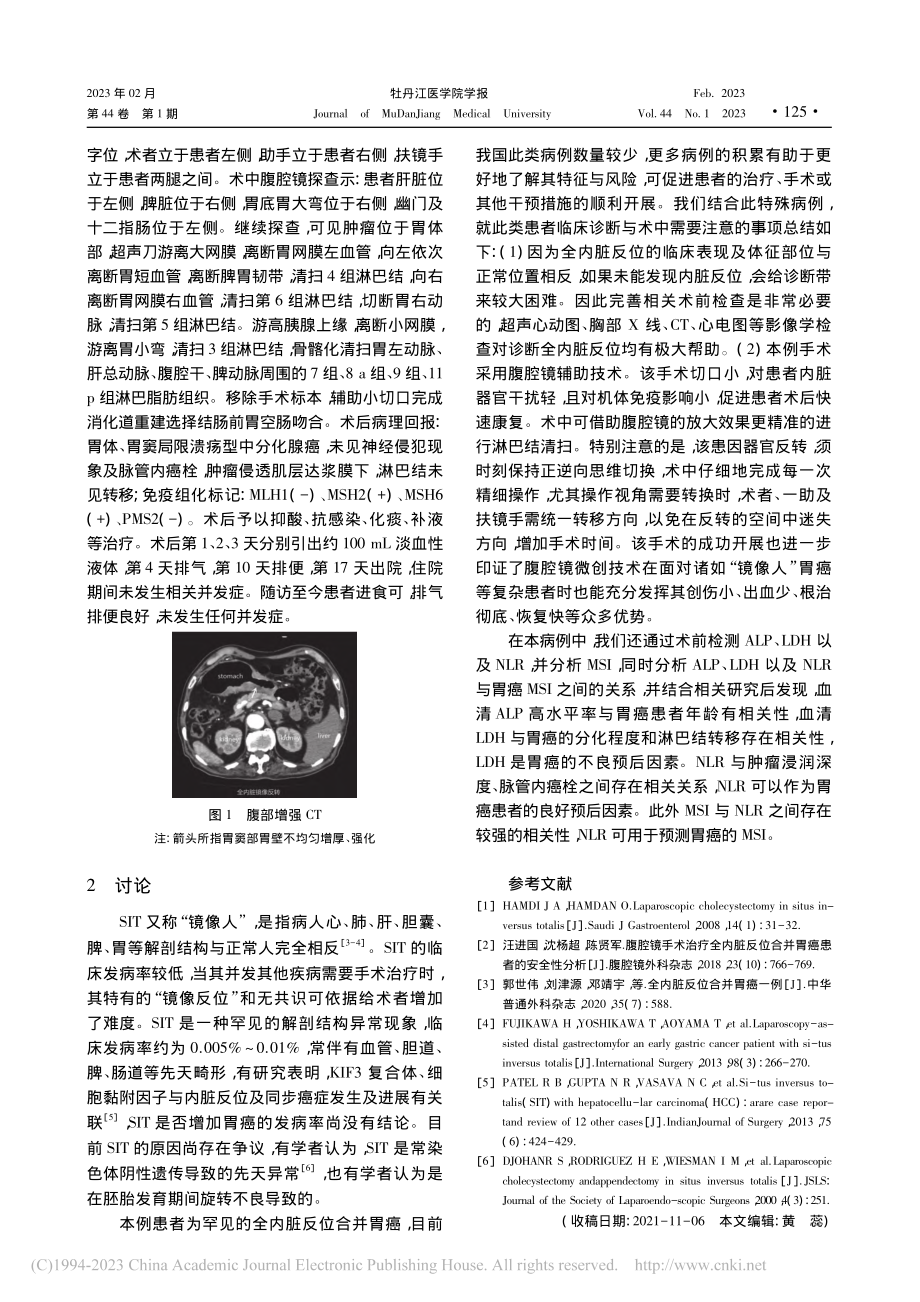 “镜面人”患者行腹腔镜下胃癌根治术1例_姜浩.pdf_第2页