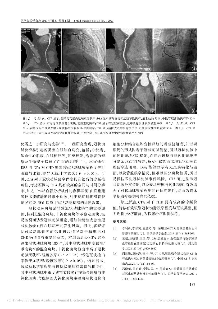 CTA与DSA评估冠心病冠状动脉狭窄程度的临床价值_万书友.pdf_第3页