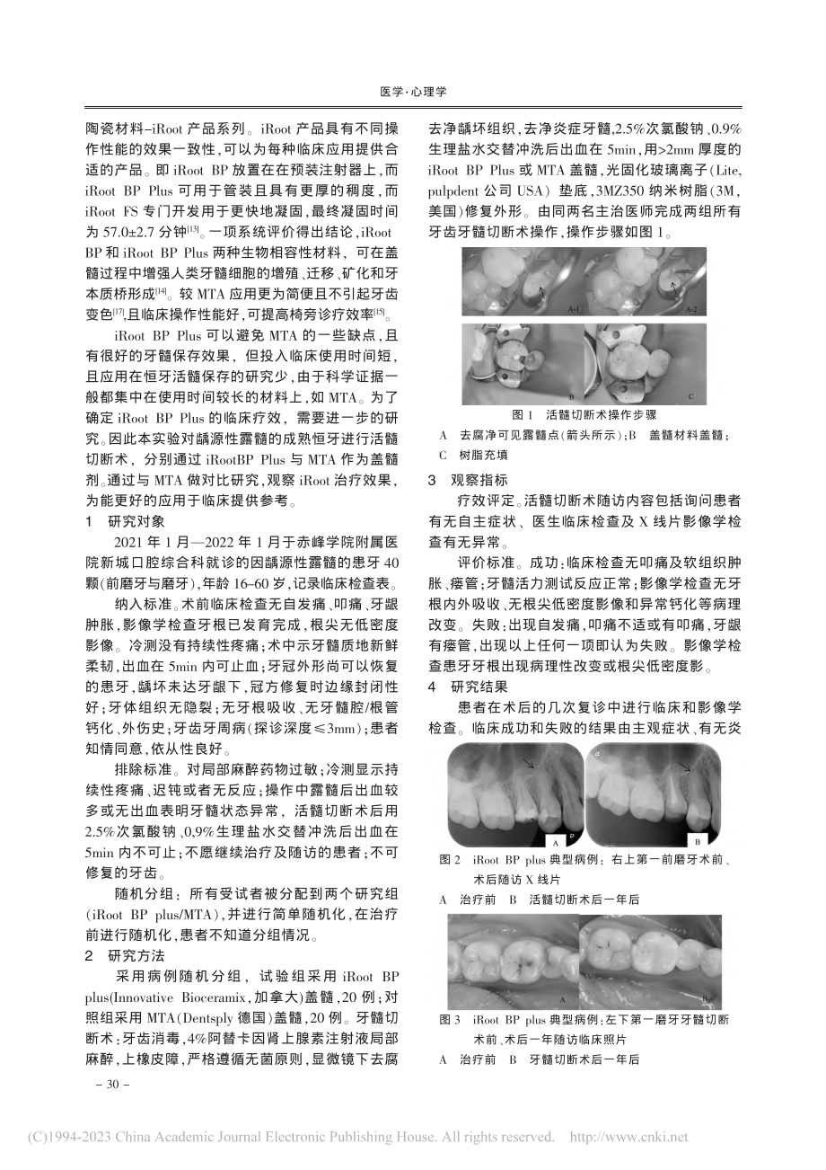 iRoot_BP_Plus...性露髓活髓切断术的临床效果_吕倩.pdf_第2页