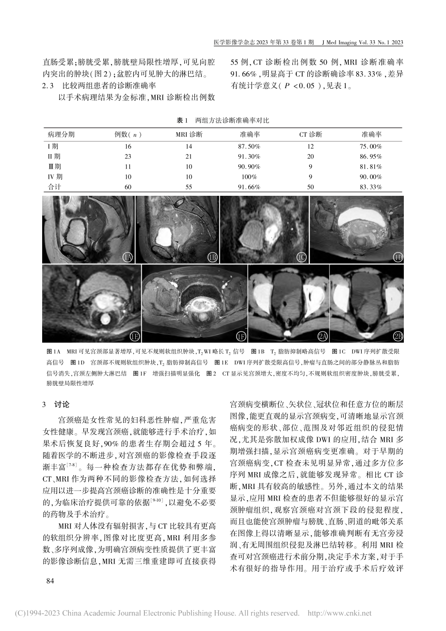 CT、MRI在宫颈癌诊断中的应用价值分析_范传朝.pdf_第3页