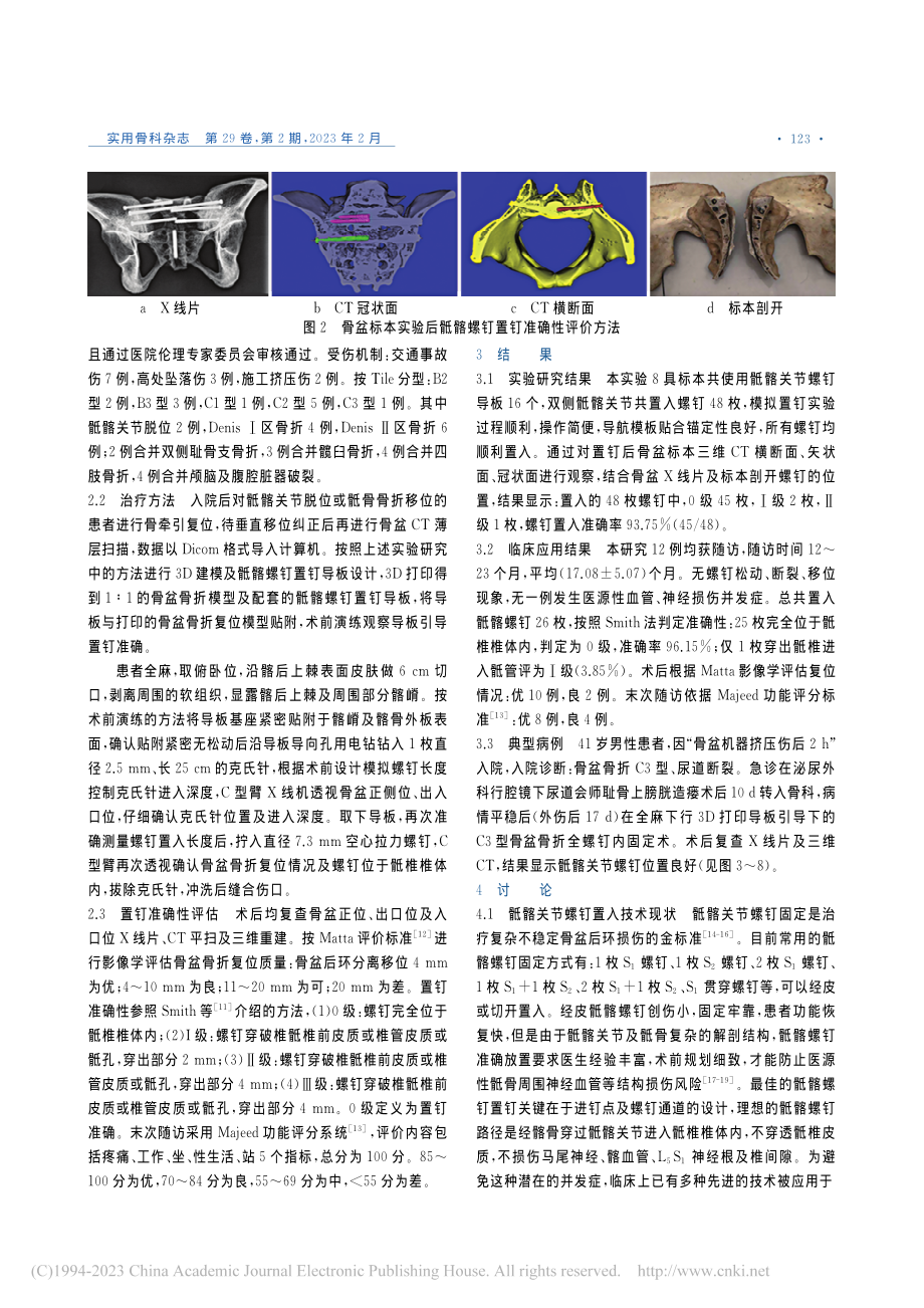 3D打印导板引导骶髂螺钉置钉实验与临床准确性评价_游木荣.pdf_第3页