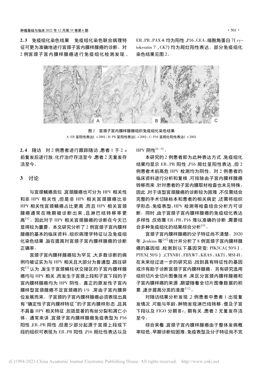 2例宫颈子宫内膜样腺癌临床病理特征分析_靳浩东.pdf_第3页