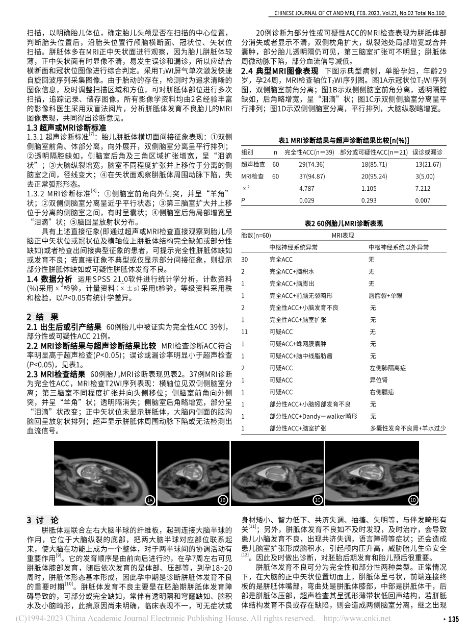 MRI诊断孕中期胎儿胼胝体发育不良的临床价值研究_刘春玲.pdf_第2页