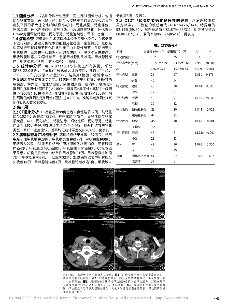 CT对甲状腺结节钙化良恶性的鉴别作用分析_魏来.pdf_第2页