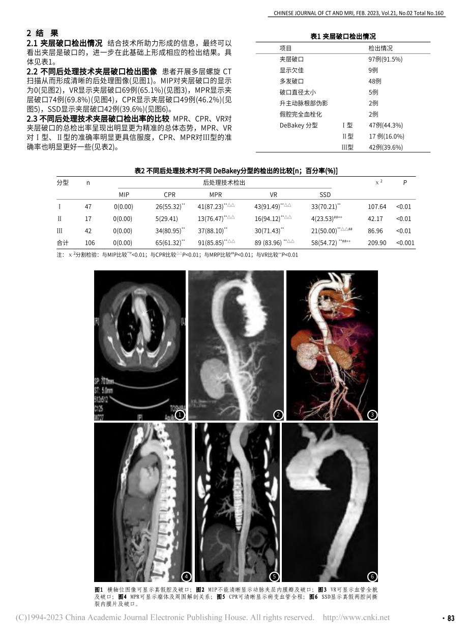 CT后处理技术显示主动脉夹层破口的比较研究_肖东健.pdf_第2页