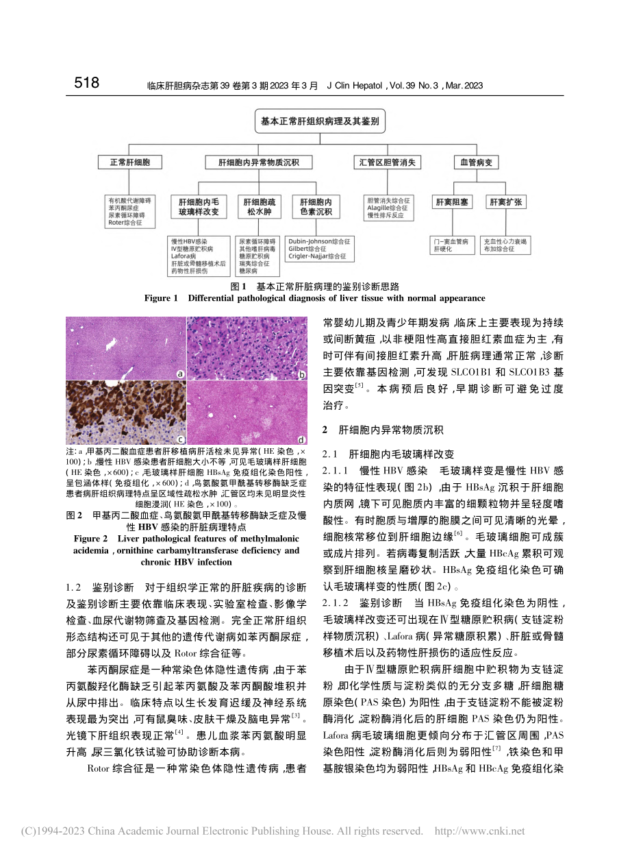 “基本正常肝组织”的病理鉴别诊断思路_张萌萌.pdf_第2页