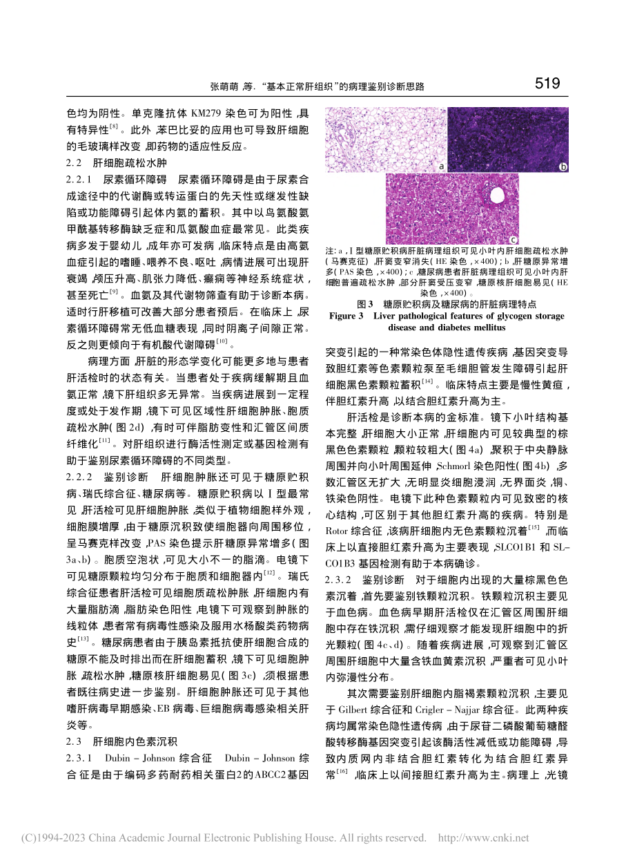 “基本正常肝组织”的病理鉴别诊断思路_张萌萌.pdf_第3页