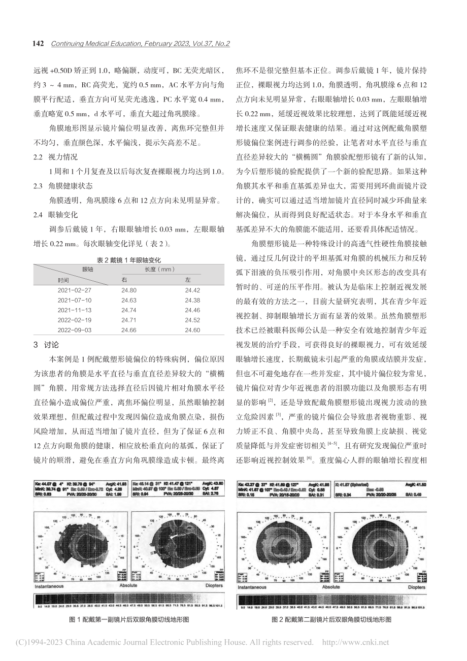 “横椭圆”角膜验配塑形镜时的处理方法探讨_陈丽娜.pdf_第3页