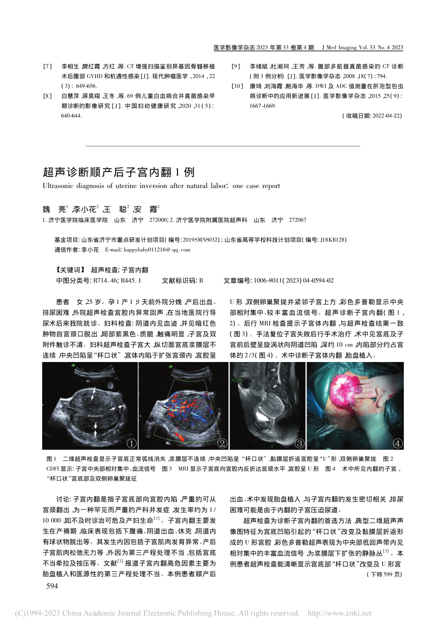 超声诊断顺产后子宫内翻1例_魏亮.pdf_第1页