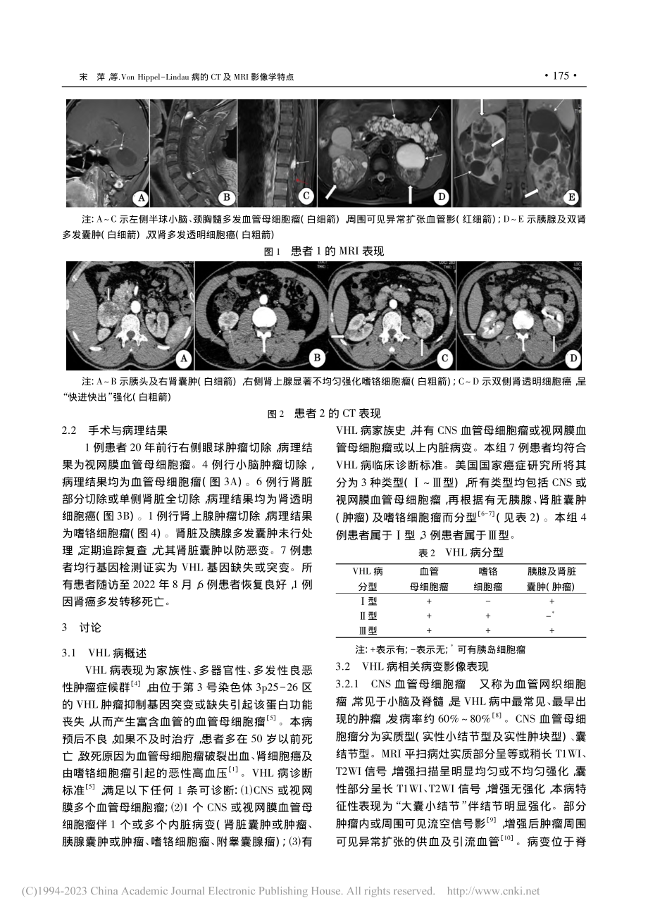 Von_Hippel-Li...病的CT及MRI影像学特点_宋萍.pdf_第3页