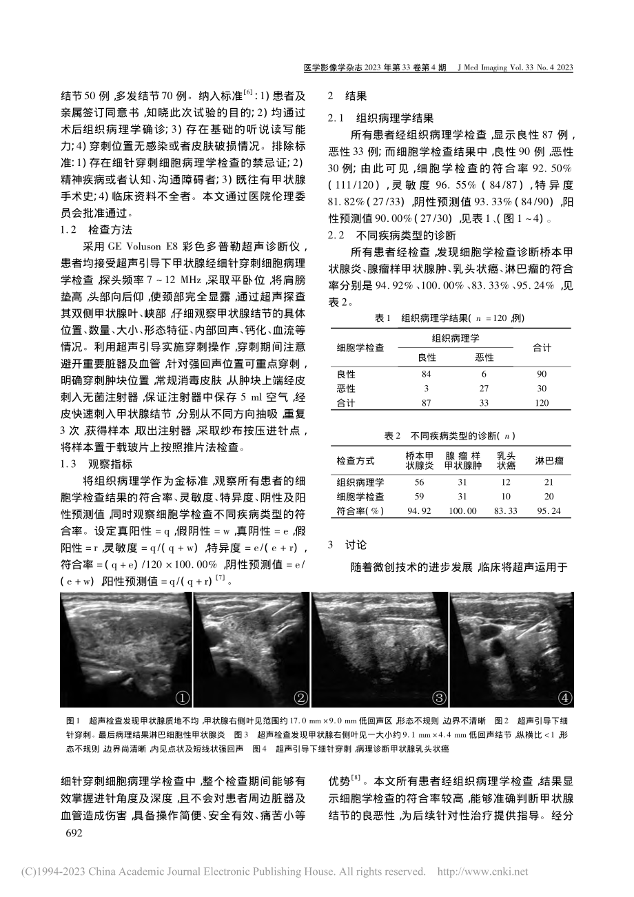 超声引导下甲状腺经细针穿刺细胞病理学检查的临床价值_步龙英.pdf_第2页