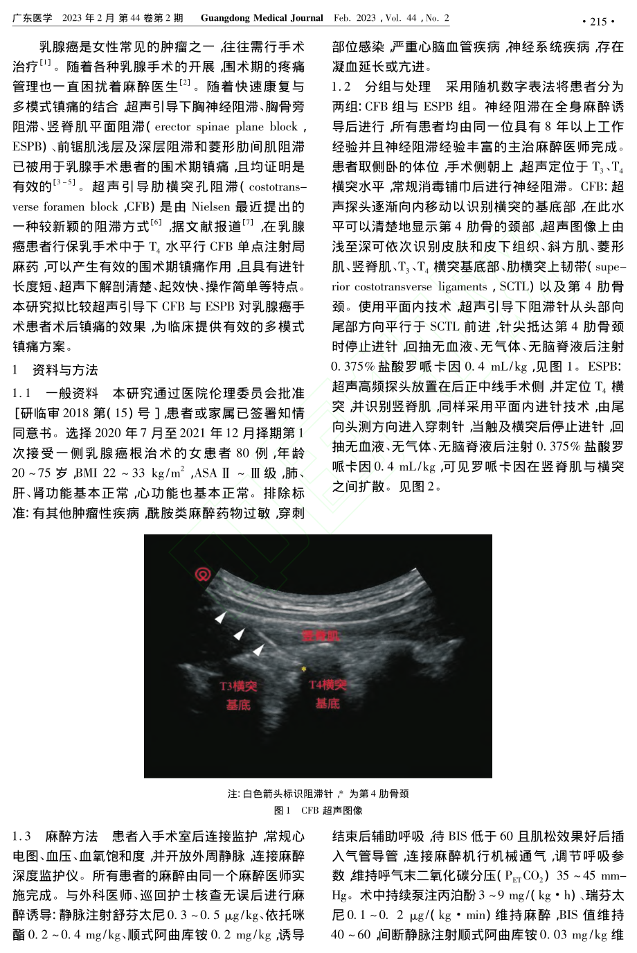 超声引导下肋横突孔阻滞和竖...腺癌患者术后镇痛效果的比较_郑小兰.pdf_第2页