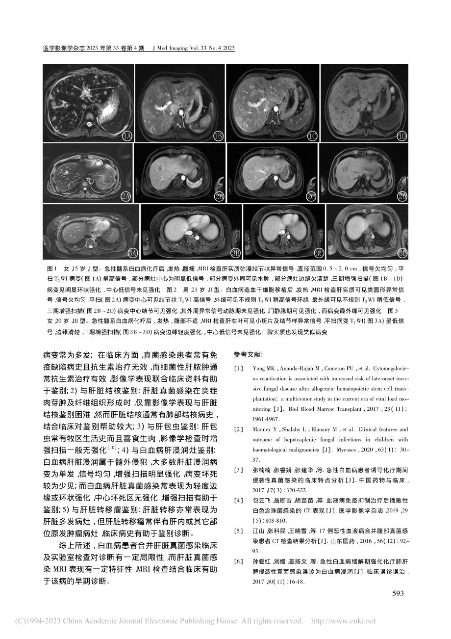 白血病合并肝脏真菌感染的MRI表现_王浩宇.pdf_第3页