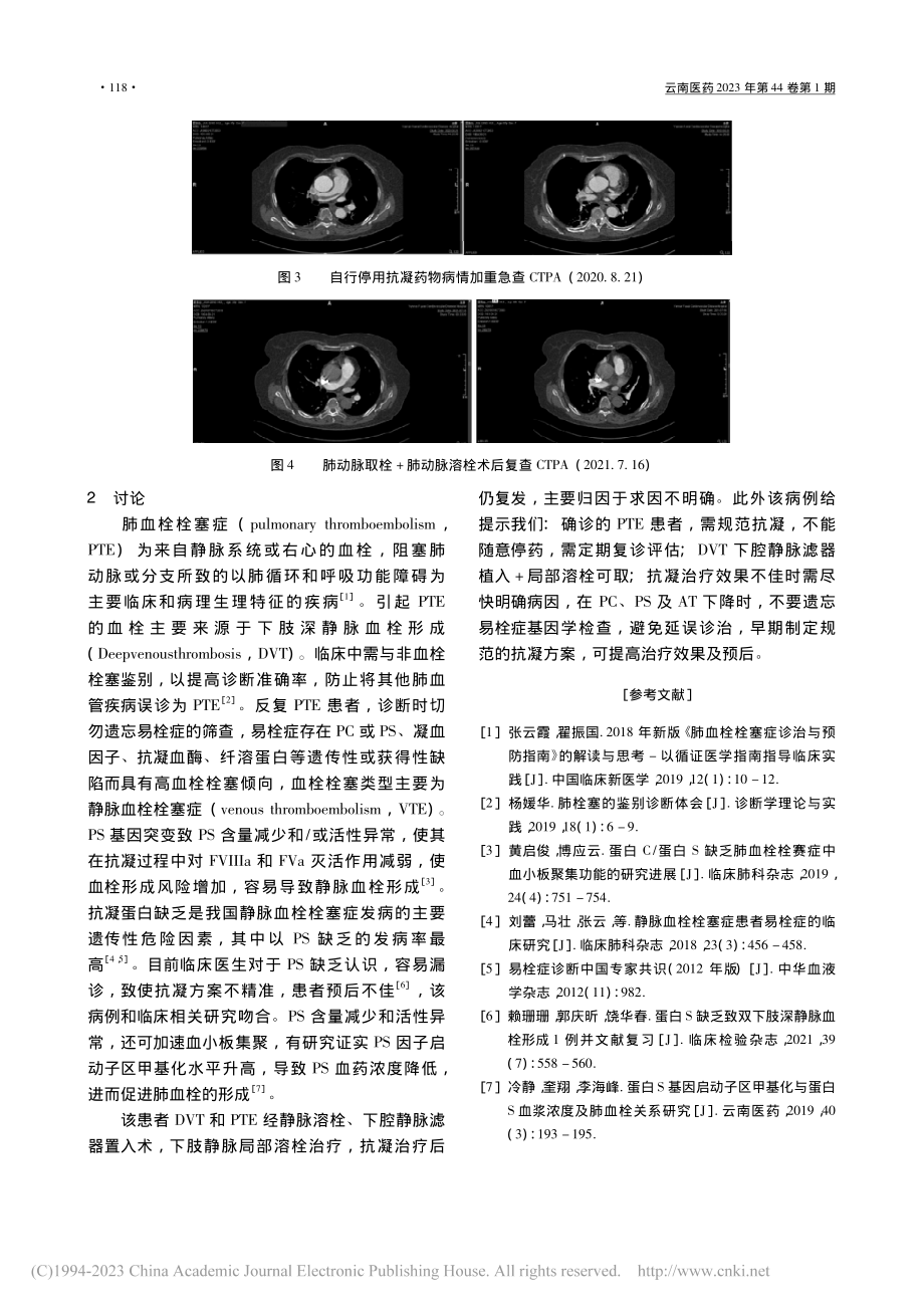 蛋白S缺乏致反复肺栓塞一例诊治体会_张宗发.pdf_第3页