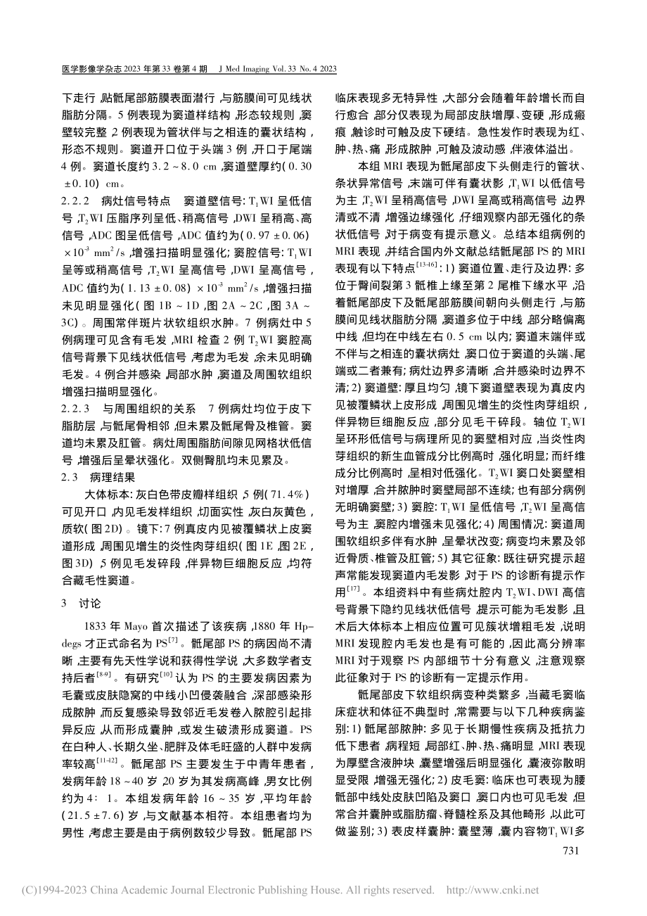 骶尾部藏毛窦的MRI表现与病理对照_莫家彬.pdf_第3页