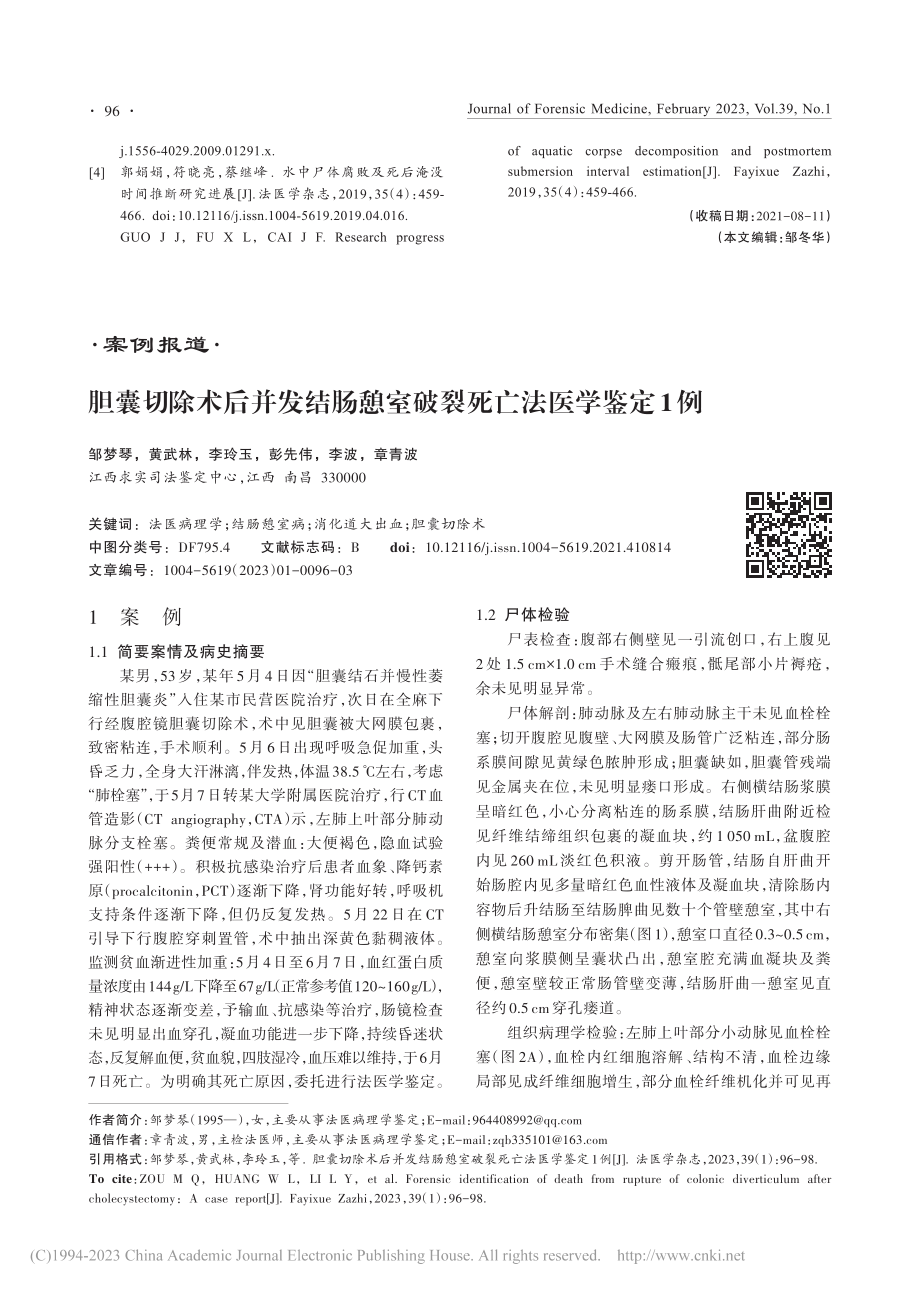 胆囊切除术后并发结肠憩室破裂死亡法医学鉴定1例_邹梦琴.pdf_第1页