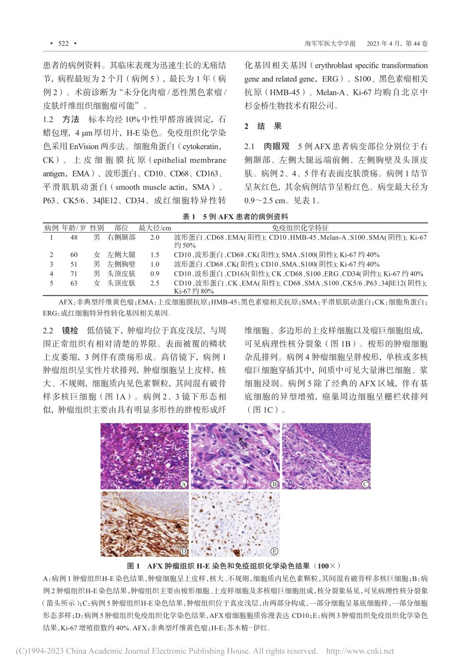 非典型纤维黄色瘤5例临床病理分析_苏晓燕.pdf_第2页