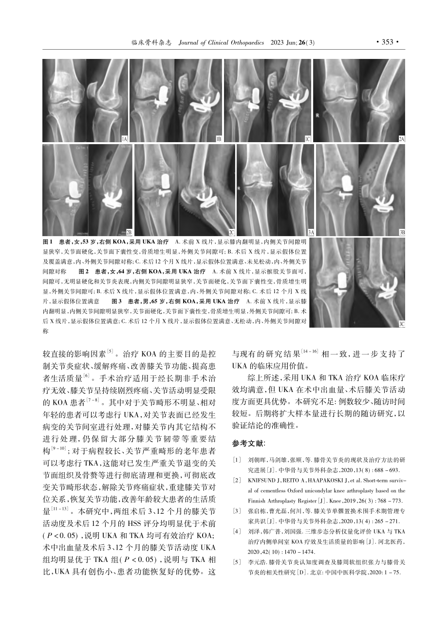 单髁膝关节置换与全膝关节置换治疗膝骨关节炎的疗效比较_王小挺.pdf_第3页