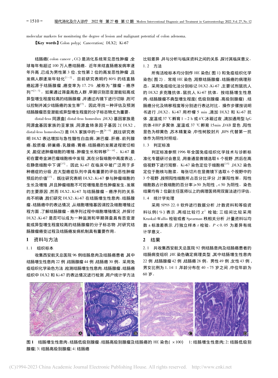 DLX2、Ki-67在结肠...-癌进程中的表达及临床意义_程永莉.pdf_第2页