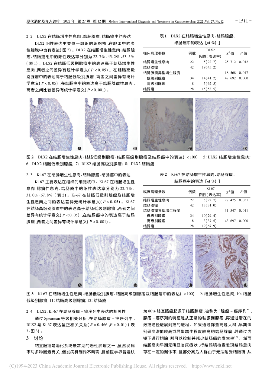 DLX2、Ki-67在结肠...-癌进程中的表达及临床意义_程永莉.pdf_第3页