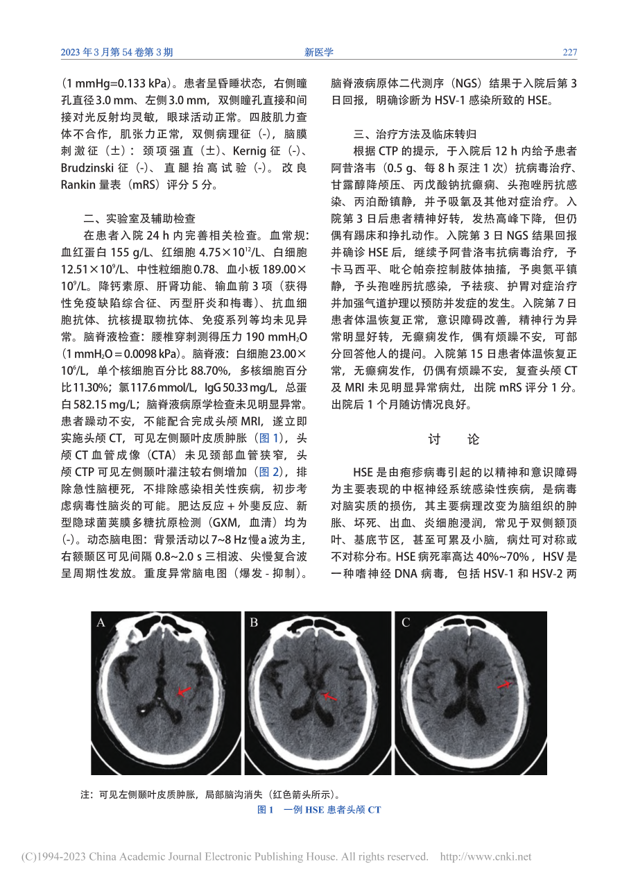 CT灌注成像辅助诊断单纯疱疹病毒1型脑炎一例_符雄琳.pdf_第2页