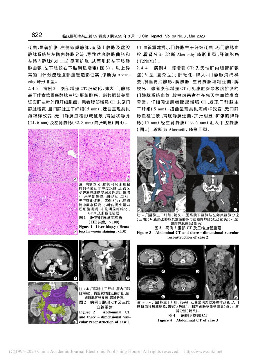 5例Abernethy畸形...静脉高压患者的临床特征分析_白婷婷.pdf_第3页